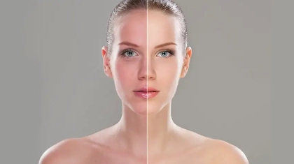 Clear Complexion Essentials: Exploring Blemish Creams and Cleansers